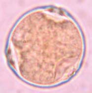 pubescens